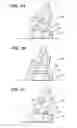 Fig. 03 - Bouncing baby chair