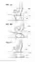 Fig. 05 - Bouncing baby chair