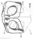 Fig. 04 - Collapsible structures having enhancements