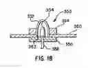 Fig. 22 - Collapsible structures having enhancements