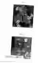 Fig. 09 - VACCINE