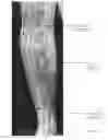 Fig. 28 - Agent for treating disease