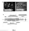 Fig. 03 - ANTITUMOR EFFECTS OF INSULIN-RESPONSIVE DNA BINDING PROTEIN-1 (IRDBP-1)