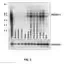 Fig. 04 - ANTITUMOR EFFECTS OF INSULIN-RESPONSIVE DNA BINDING PROTEIN-1 (IRDBP-1)