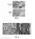 Fig. 06 - ANTITUMOR EFFECTS OF INSULIN-RESPONSIVE DNA BINDING PROTEIN-1 (IRDBP-1)