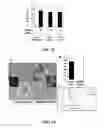 Fig. 10 - ANTITUMOR EFFECTS OF INSULIN-RESPONSIVE DNA BINDING PROTEIN-1 (IRDBP-1)