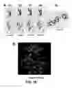Fig. 12 - ANTITUMOR EFFECTS OF INSULIN-RESPONSIVE DNA BINDING PROTEIN-1 (IRDBP-1)