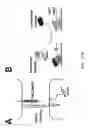 Fig. 02 - Targeting of Notch3 Receptor Function for Cancer Therapy