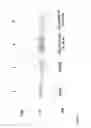 Fig. 07 - Future cardiac event biomarkers CCL3, CCL5 and CCL18