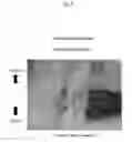 Fig. 07 - MATERIAL FOR PREVENTING TISSUE ADHESION AND MATERIAL FOR PREVENTING JOINT CONTRACTURE
