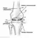 Fig. 01 - Tissue Engineered Meniscus Repair Composition