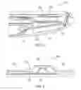 Fig. 03 - Handheld device assembly