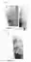 Fig. 02 - MULTI-LAYER STRUCTURED CARBONACEOUS MATERIAL, PROCESS FOR PRODUCING THE SAME, AND NONAQUEOUS SECONDARY BATTERY ADOPTING THE SAME