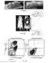 Fig. 02 - Compositions and methods for determining cancer stem cell self-renewal potential