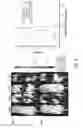 Fig. 16 - Compositions and methods for determining cancer stem cell self-renewal potential