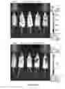Fig. 21 - Compositions and methods for determining cancer stem cell self-renewal potential