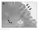 Fig. 01 - METHODS OF SCREENING FOR GASTRIC CANCER