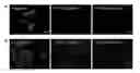 Fig. 01 - Fluorescent dye-labeled glucose bioprobe, synthesis method and usage thereof