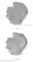 Fig. 10 - Determining an expression status of human epidermal growth factor receptor 2 (HER2) in a biological sample