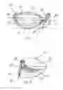 Fig. 05 - Clubhead with external hosel