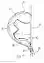 Fig. 06 - Clubhead with external hosel