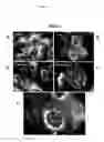 Fig. 09 - Compounds for the treatment of proliferative disorders
