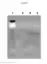 Fig. 04 - Compositions for treating dry eye disease