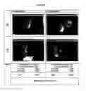 Fig. 10 - METHOD OF REVERSING, PREVENTING, DELAYING OR STABILIZING SOFT TISSUE CALCIFICATION