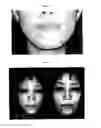Fig. 02 - External preparation for skin