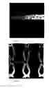 Fig. 08 - Methods for fabricating polymer-bioceramic composite implantable medical devices