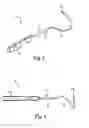 Fig. 03 - Method of treating anal incontinence