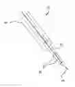 Fig. 01 - Systems for engaging a bodily tissue and methods of using the same