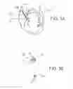 Fig. 06 - Systems for engaging a bodily tissue and methods of using the same