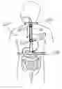 Fig. 01 - Apparatus and methods for capsule endoscopy of the esophagus