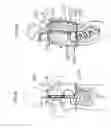 Fig. 04 - Apparatus and methods for capsule endoscopy of the esophagus