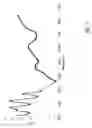 Fig. 06 - DETERMINATION OF BLOOD PUMP SYSTEM PERFORMANCE AND SAMPLE DILUTION USING A PROPERTY OF FLUID BEING TRANSPORTED