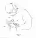 Fig. 07 - Systems and methods for intra-operative regional neural stimulation
