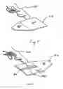 Fig. 06 - Functional low-profile dynamic extension splint and methods for its use and manufacture