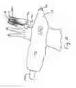 Fig. 10 - Functional low-profile dynamic extension splint and methods for its use and manufacture