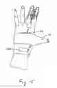 Fig. 12 - Functional low-profile dynamic extension splint and methods for its use and manufacture