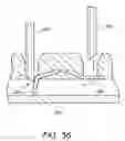 Fig. 35 - Device and method for vascular access