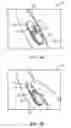 Fig. 03 - ADHESIVE SKIN PATCH WITH PUMP FOR SUBCUTANEOUS DRUG DELIVERY