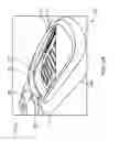 Fig. 07 - ADHESIVE SKIN PATCH WITH PUMP FOR SUBCUTANEOUS DRUG DELIVERY