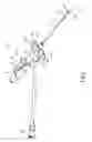Fig. 02 - INDWELLING NEEDLE ASSEMBLY