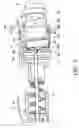 Fig. 06 - INDWELLING NEEDLE ASSEMBLY