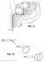 Fig. 07 - Implantable device for controlled drug delivery