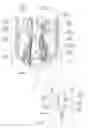 Fig. 02 - Apparatus, systems, and methods for achieving intravascular, thermally-induced renal neuromodulation