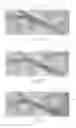 Fig. 33 - Apparatus, systems, and methods for achieving intravascular, thermally-induced renal neuromodulation