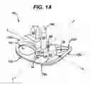 Fig. 02 - Vertebral staples and insertion tools