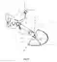 Fig. 06 - Hip surgery assembly